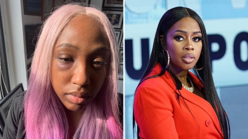 brittany taylor black eye punched remy ma report 1